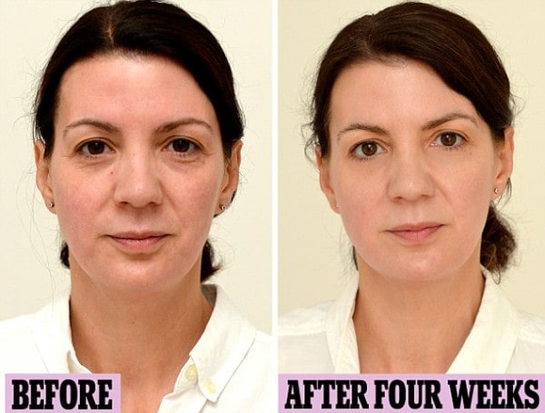 Woman Drinks Gallon Of Water Every Day For Four Weeks And The Final Picture Results Are Amazing