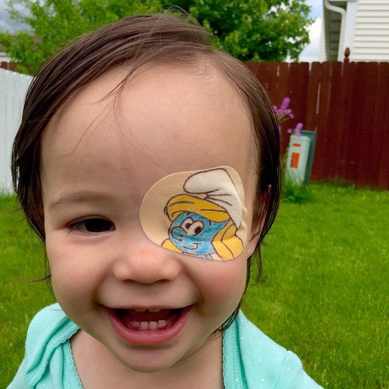 This Little Girl Has to Wear an Eyepatch! Her Dad Makes It Fun For Her On The Most Adorable Way