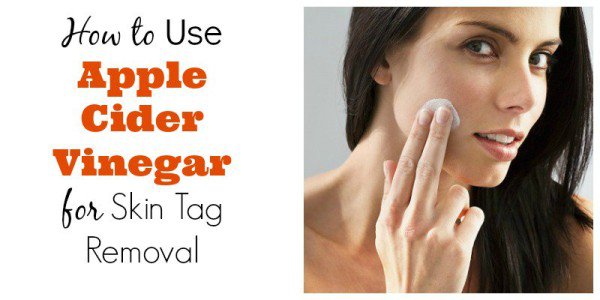 Surprising Apple Cider Vinegar Uses