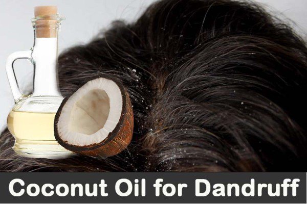 9 Of The Best And Most Useful Home DIY Hacks To Get Rid Of Dandruff And Itchy Scalp