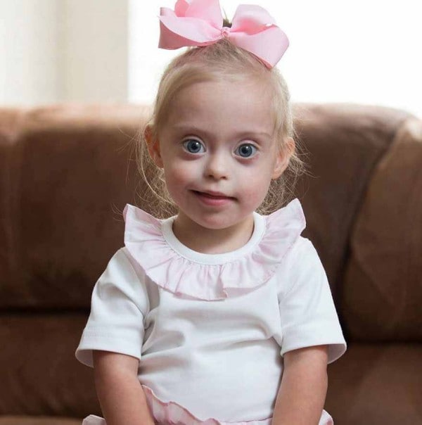 This 2 year old Down Syndrome Girl Got A Modeling Contracts Due To Her Charming Smile