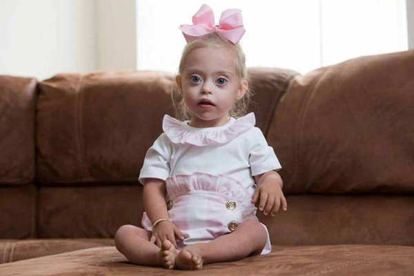 This 2 year old Down Syndrome Girl Got A Modeling Contracts Due To Her Charming Smile