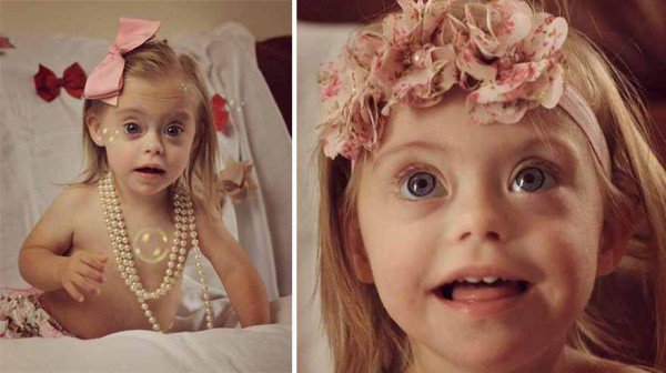 This 2 year old Down Syndrome Girl Got A Modeling Contracts Due To Her Charming Smile