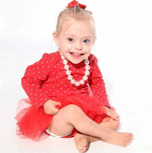 This 2 year old Down Syndrome Girl Got A Modeling Contracts Due To Her Charming Smile