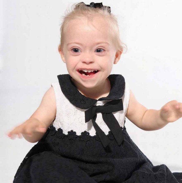 This 2 year old Down Syndrome Girl Got A Modeling Contracts Due To Her Charming Smile