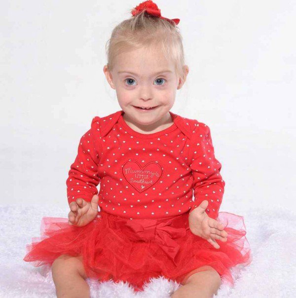 This 2 year old Down Syndrome Girl Got A Modeling Contracts Due To Her Charming Smile