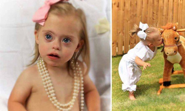 This 2 year old Down Syndrome Girl Got A Modeling Contracts Due To Her Charming Smile