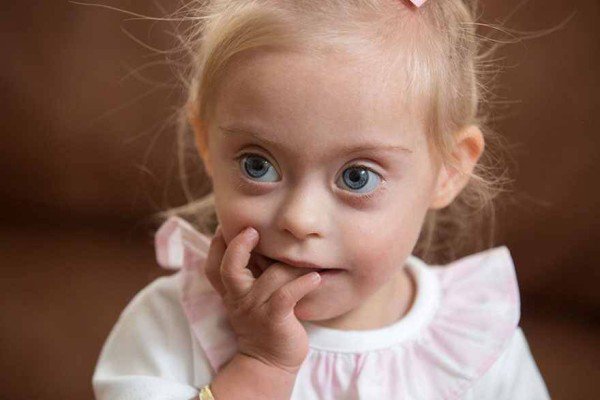 This 2 year old Down Syndrome Girl Got A Modeling Contracts Due To Her Charming Smile
