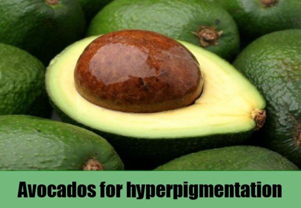 15 Of The Most Amazing  Benefits Of Avocado For Skin, Hair And Health