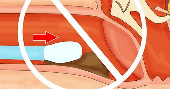 After Seeing THIS, You’ll Never Use Cotton Swabs To Clean Your Ears Again