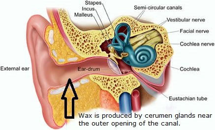 After Seeing THIS, You’ll Never Use Cotton Swabs To Clean Your Ears Again