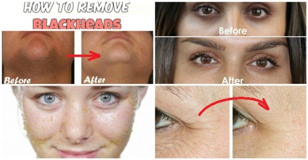8 Super Simple Homemade Beauty Tips For Face Skin And Hair Every