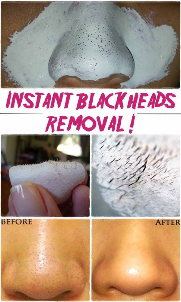 10 Effective Must know Beauty Hacks You Can Easily Do At Home