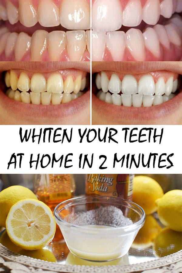 teeth whiten minutes beauty whitening hacks know tricks natural ingredients effective easily must diy timeless own tooth care dentes tips