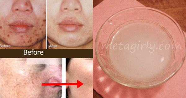 9 Smart Absolutely Easy Beauty Care Tips And Hacks Every Woman Should Know