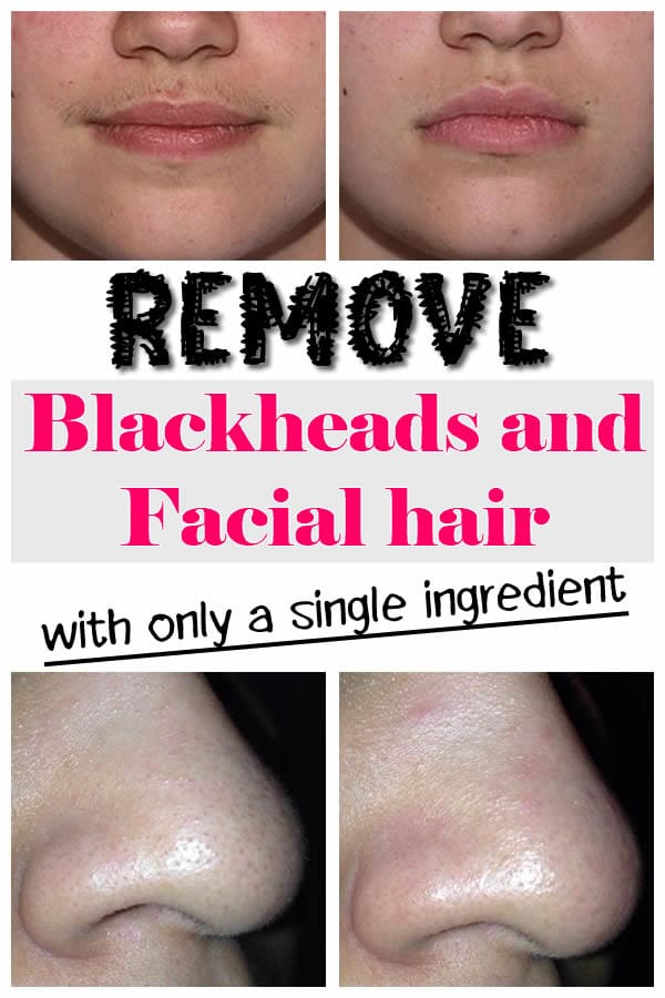 7 Spectacular Beauty Care Hack That Will Impress Every Woman Who Will Try Them