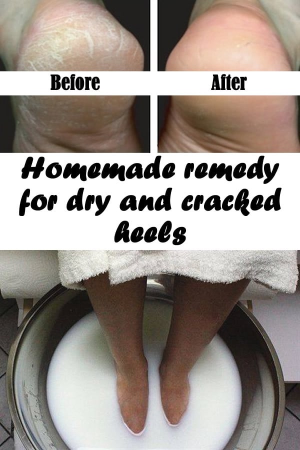 7 Ingeniously Effective Beauty Care Hacks And Tips That Will Make Your Life Easier