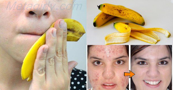 10 Life Changing Beauty Care Hacks You Have To Try Right Now