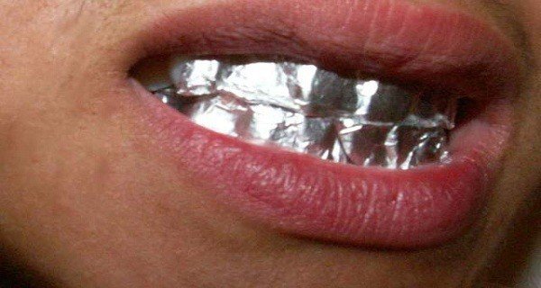 What Will Happen If You Keep Aluminum Foil on Your Teeth for 1 Hour?