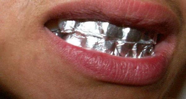 What Will Happen If You Keep Aluminum Foil on Your Teeth ...