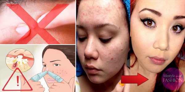 8 Cheap And Easy DIY Homemade Beauty Care Hacks You Should Know