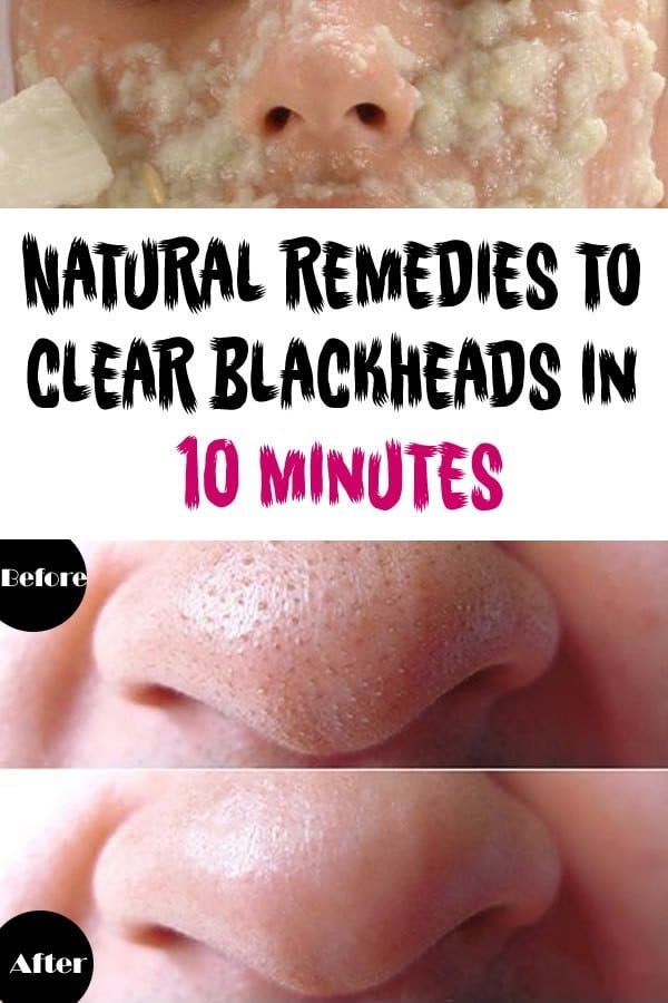 8 Unusual, Super Useful Beauty Care Tricks and Tips For Fabulously Look