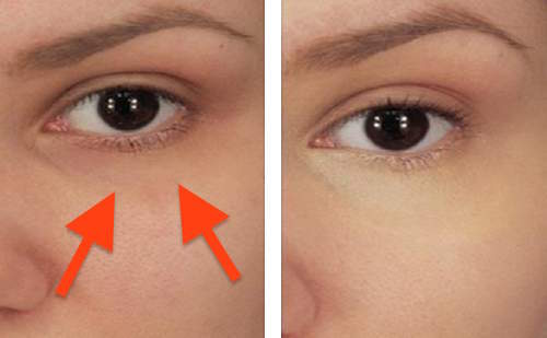 She Put Some Baking Soda Under Her Eyes, The Result Is Wonderful And It Will Impress you