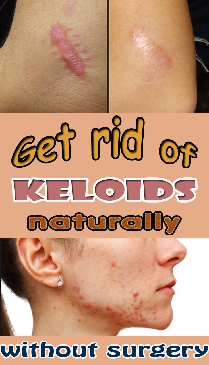 8 Quick And Useful Beauty Care Hacks That You Should Try ALL FOR