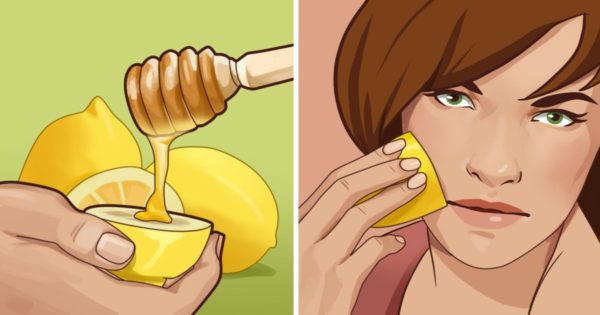 9 Beauty Tips, That Every Woman With Problematic Skin Should Know