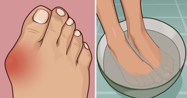 9 Beauty Tips, That Every Woman With Problematic Skin Should Know