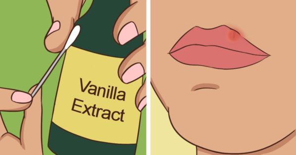 9 Beauty Tips, That Every Woman With Problematic Skin Should Know