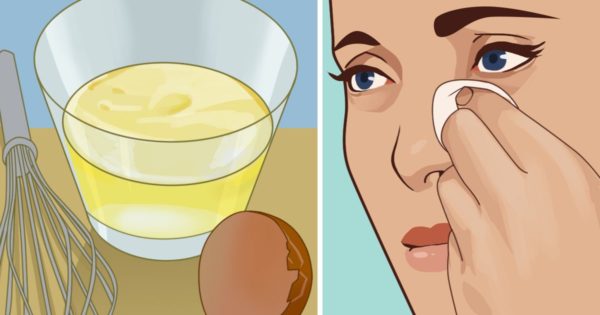 9 Beauty Tips, That Every Woman With Problematic Skin Should Know