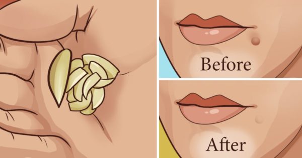 9 Ingenious Beauty Care Hacks Useful For Every GIrl