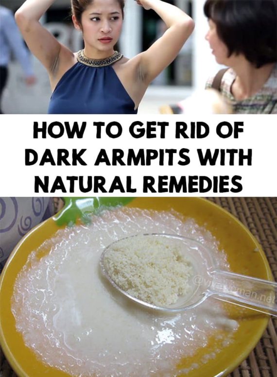 8 Easy Tricks That Will Help You Say Goodbye To Some Of The Biggest