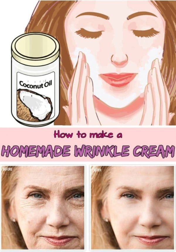 8 Useful Homemade Remedies We Should All Know