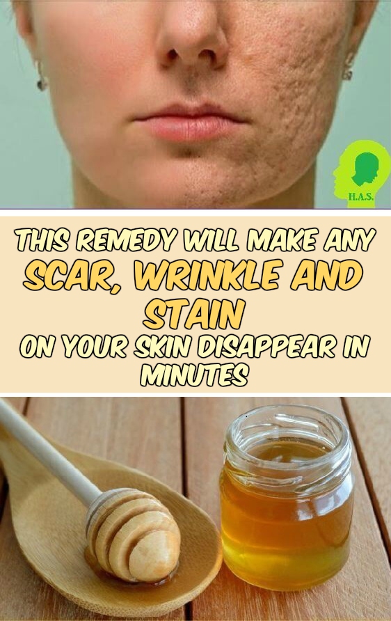 Seven Natural Homemade Remedies That Will Help Every Woman In Her Struggle With Beauty Problems