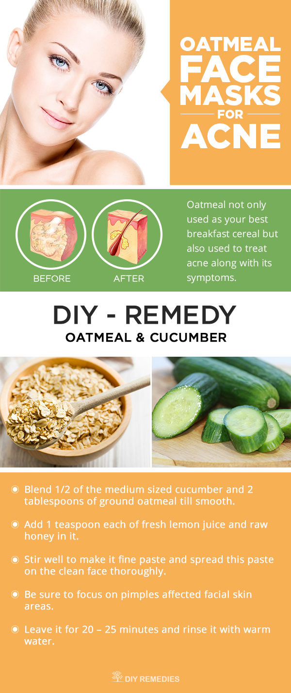 The Best Cucumber Remedies To Get Rid Of Your Beauty Problems