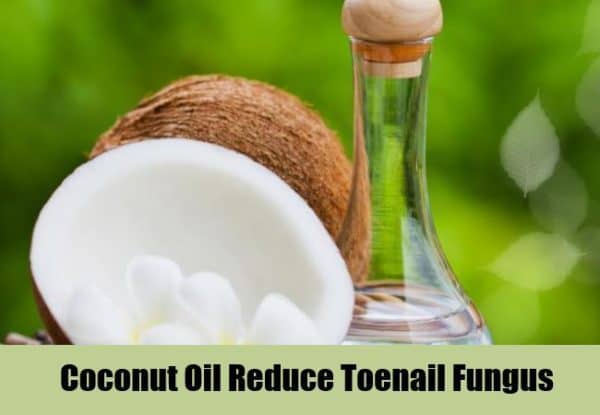 Useful Homemade Remedies For Toe Nail Fungi