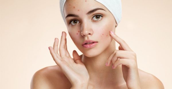 Effective Homemade Remedies To Deal With Blackheads