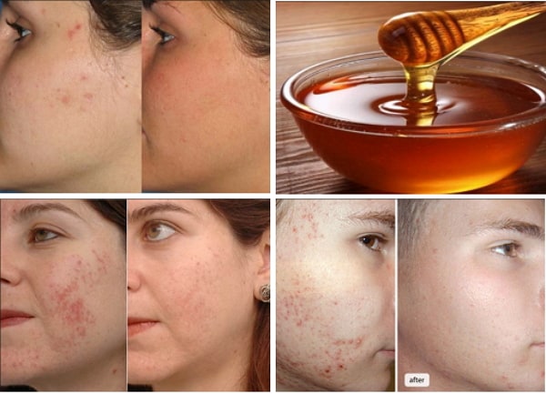 Honey Beauty Tricks That You Didnt Know