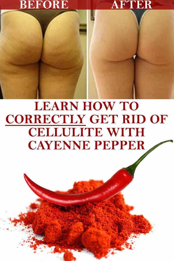 How To Get Rid Of Cellulite Naturally, Quickly And Easily