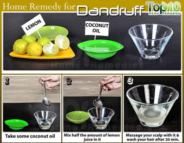 Homemade Anti Dandruff Remedies For Best Results Overnight