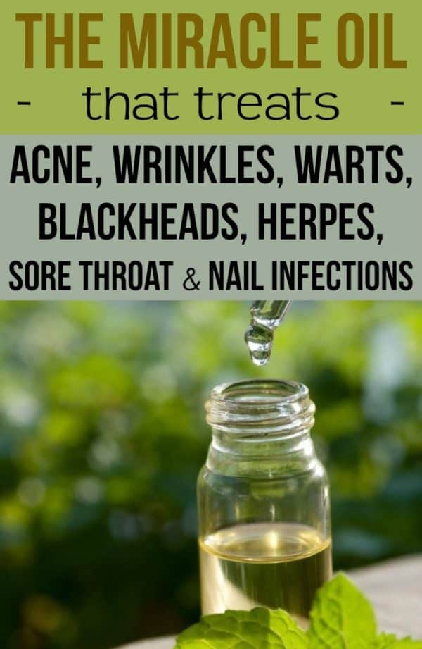 Effective Homemade Remedies To Cure Herpes - ALL FOR FASHION DESIGN