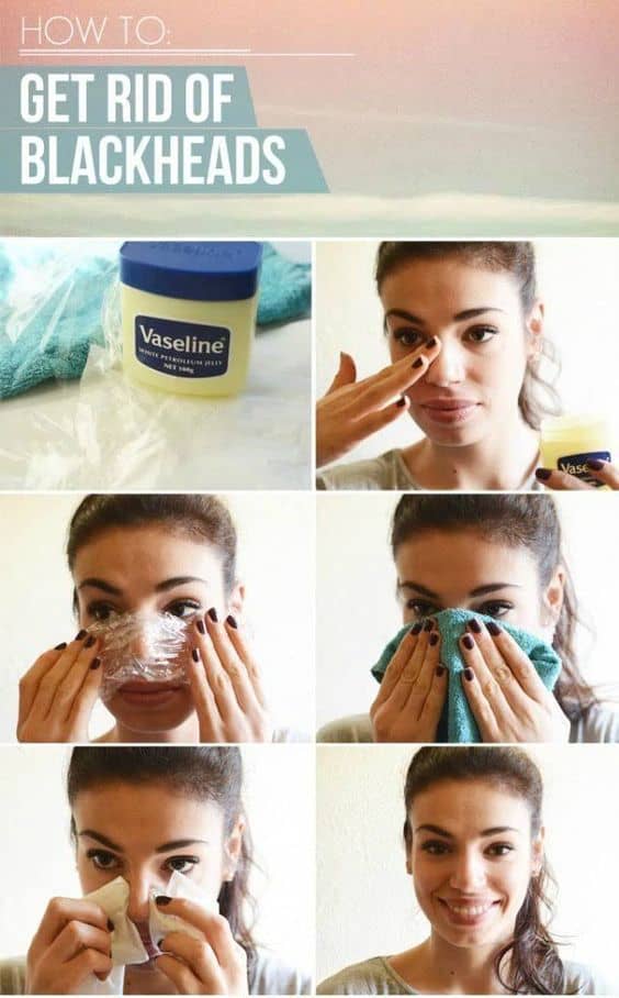 Awesome Homemade Blackheads Removers That Are Easy To Make