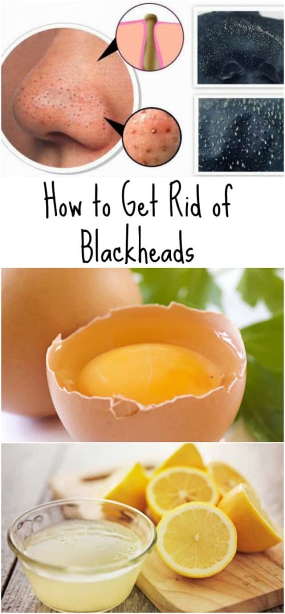 Awesome Homemade Blackheads Removers That Are Easy To Make All For Fashion Design