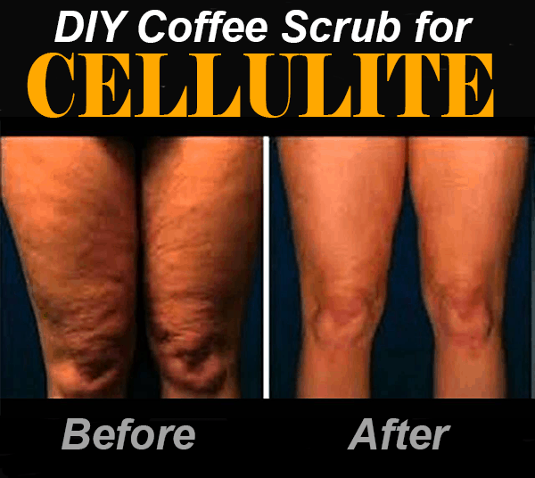 Homemade Anti Cellulite Coffee Scrubs