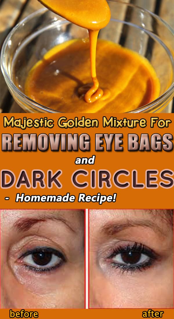 how to remove the dark circles under eyes at home