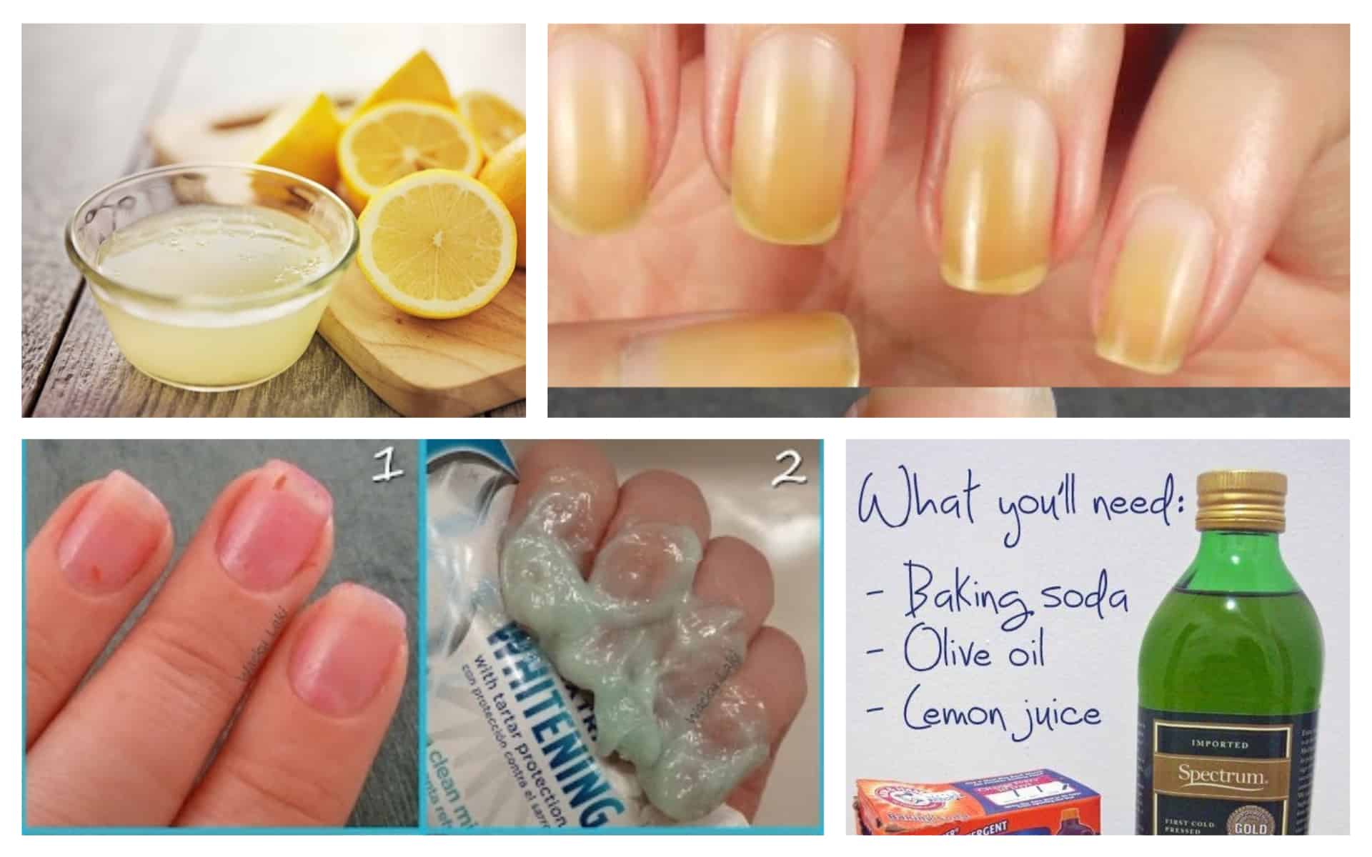 Effective Homemade Nail Whitening Ideas That You Should Try Now ALL