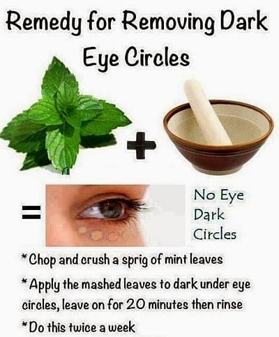 Natural Remedies That Will Help You Remove The Dark Circles Under Your Eyes