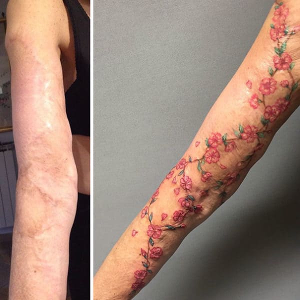 Scar Cover Up Tattoos That Will Amaze You